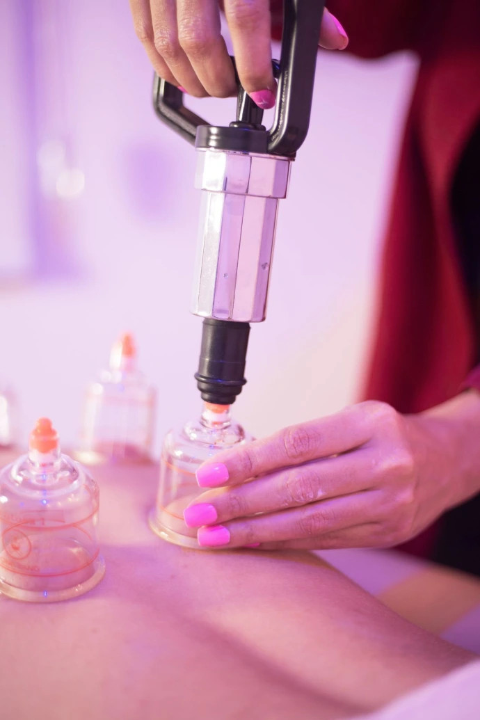 ​Therapeutic myofascial cupping and clinical hijama therapy